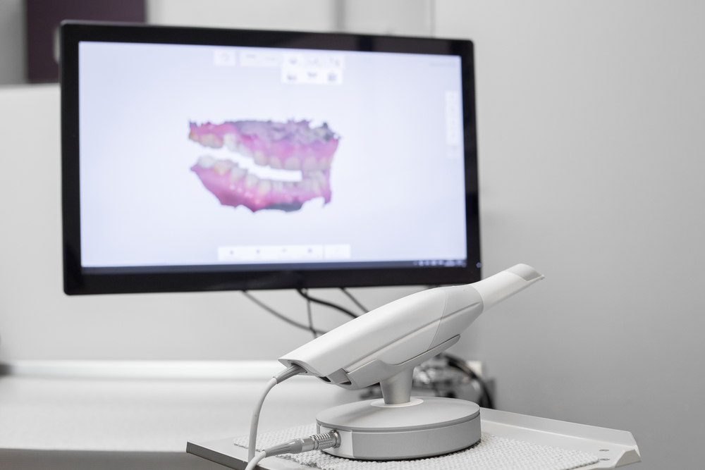 Digital dental technology, iTero Digital Scanner at Griffith Dental in Port Richey FL